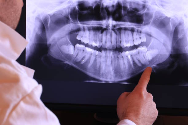 Best Emergency Tooth Extraction in Bylas, AZ