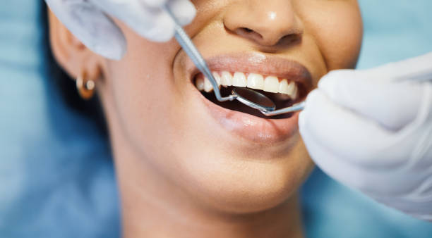 Best Emergency Broken Tooth Repair in Bylas, AZ